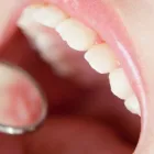 予防歯科
